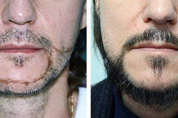 Почему у татар не растет борода