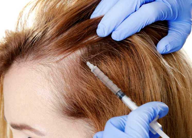 Почему выпадают волосы после наркоза и как их восстановить?
