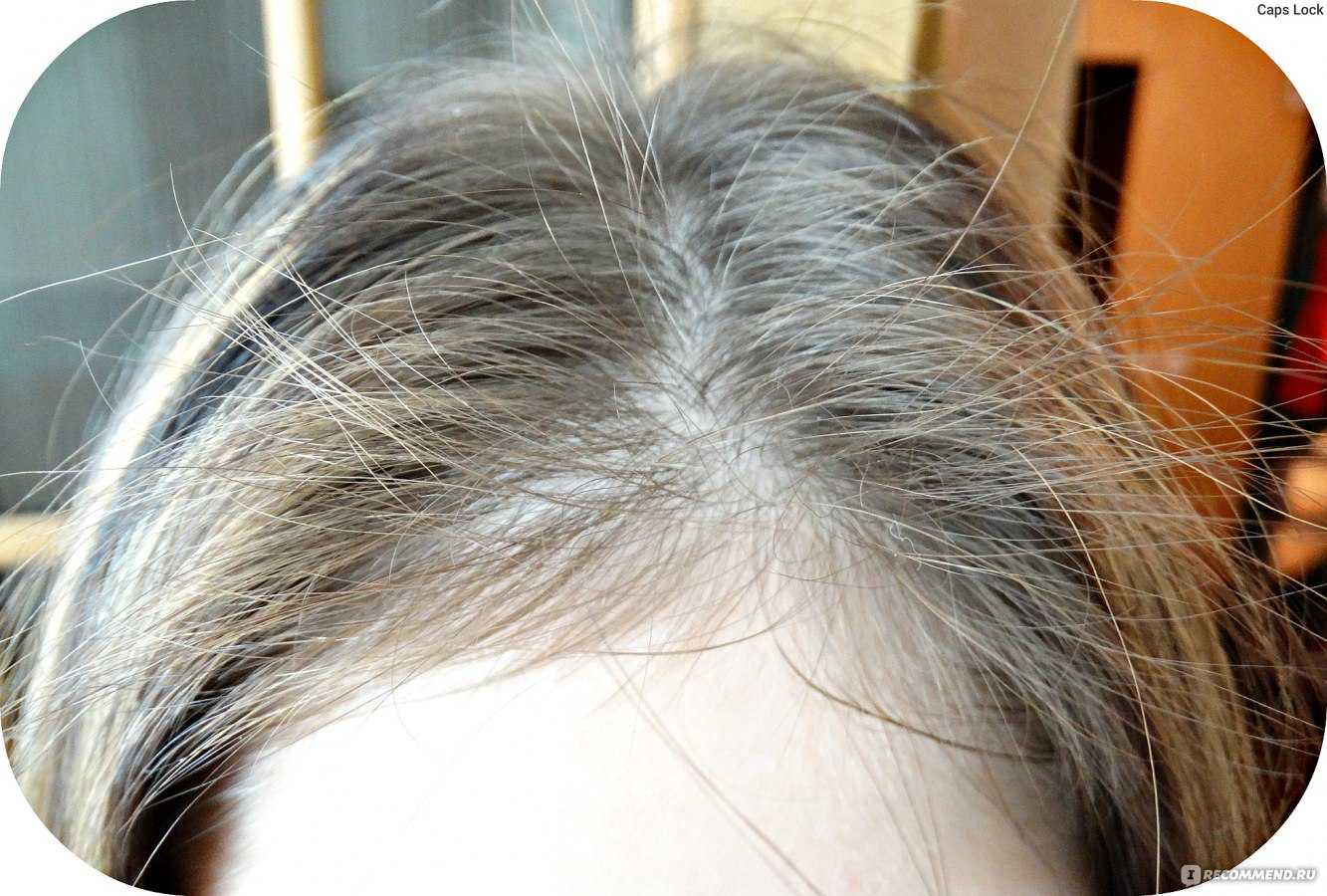 Остановить падение: как вернуть волосам здоровье и густоту
