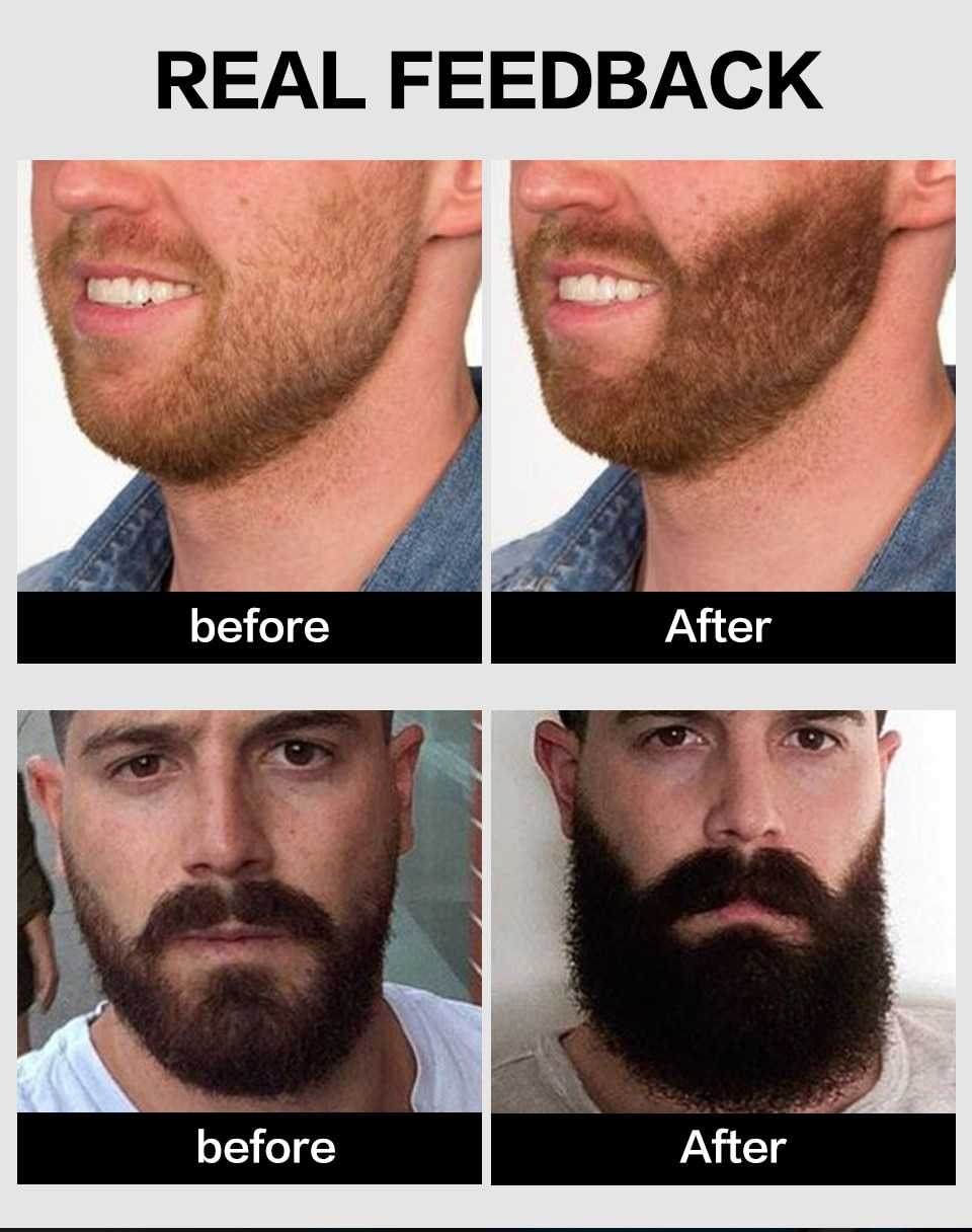 Сколько месяцев растёт борода