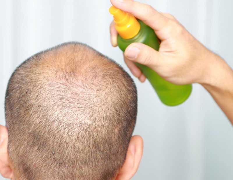 Как и чем укрепить волосы от выпадения
