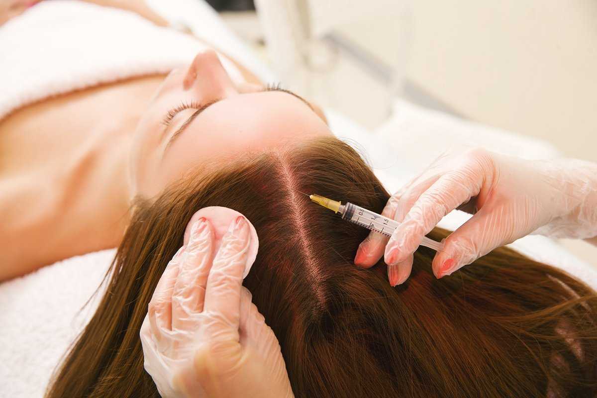 Что такое мезотерапия для волос и как она проводится?