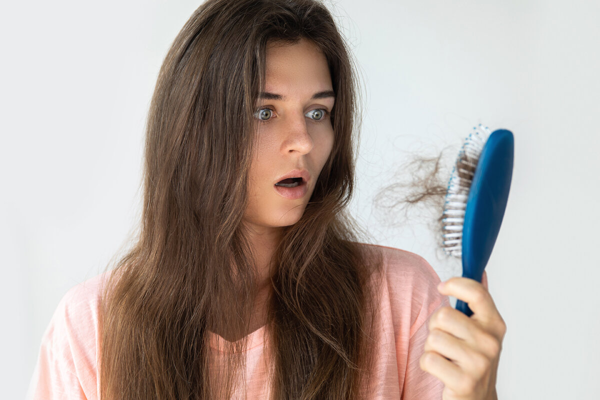 Причины, симптомы, стадии гнездной алопеции у женщин, и как можно остановить выпадение волос