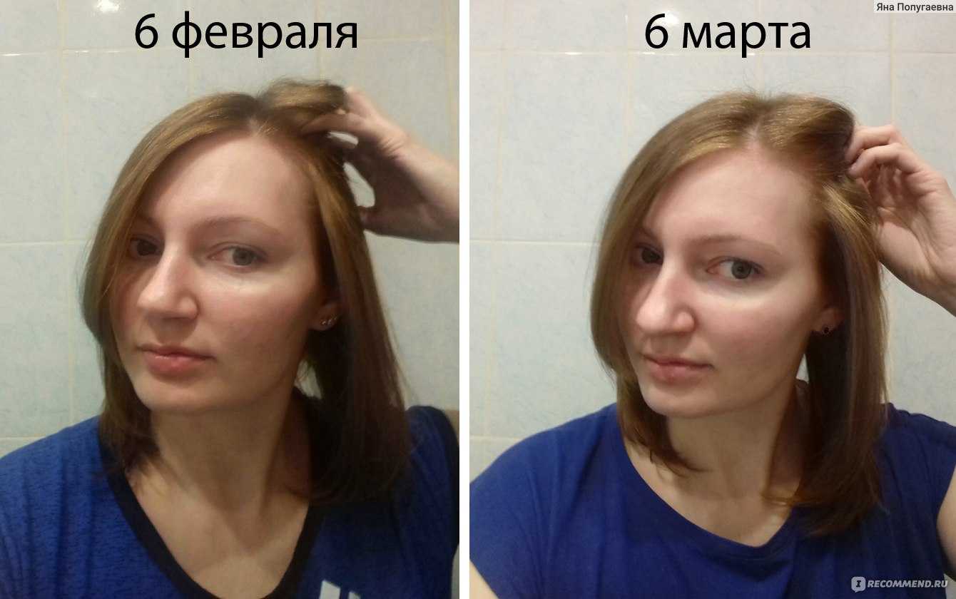 Луков маска для волос отзывы. Луковая маска для волос до и после. Маска для волос до и после. Волосы после луковой маски до и после. Луковая маска для волос фото до и после.