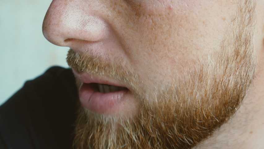 Почему растут усы без бороды