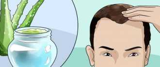 Обзор лучших средств для лечения себореи кожи головы