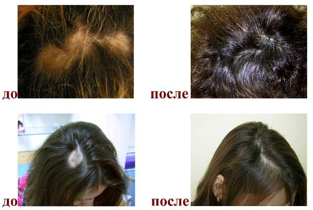 Сатура роста для волос: отзывы, специфические особенности применения и состав бальзама