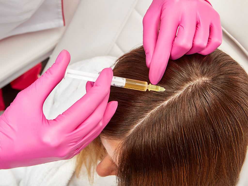 Криомассаж волосистой части головы