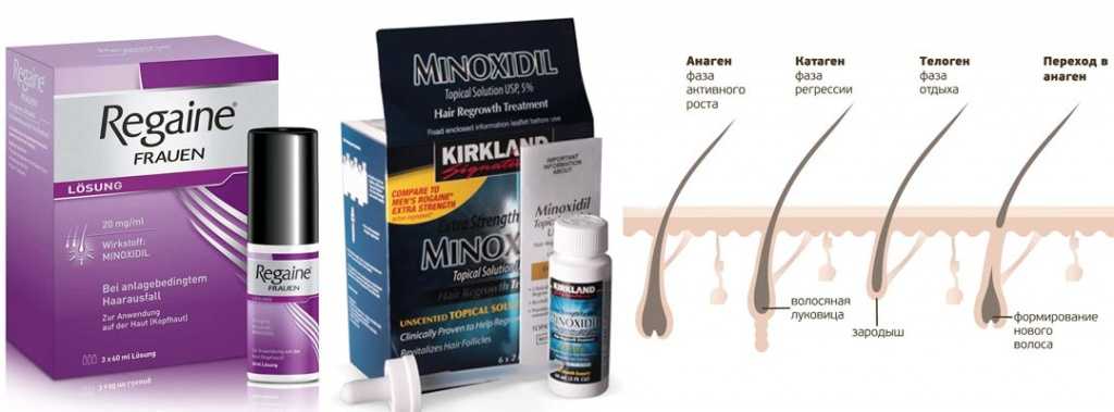 Миноксидил аналоги. Средство для роста волос миноксидил для мужчин. Миноксидил для волос препараты. Миноксидил 5 для волос для женщин. Миноксидил алерана эффект.