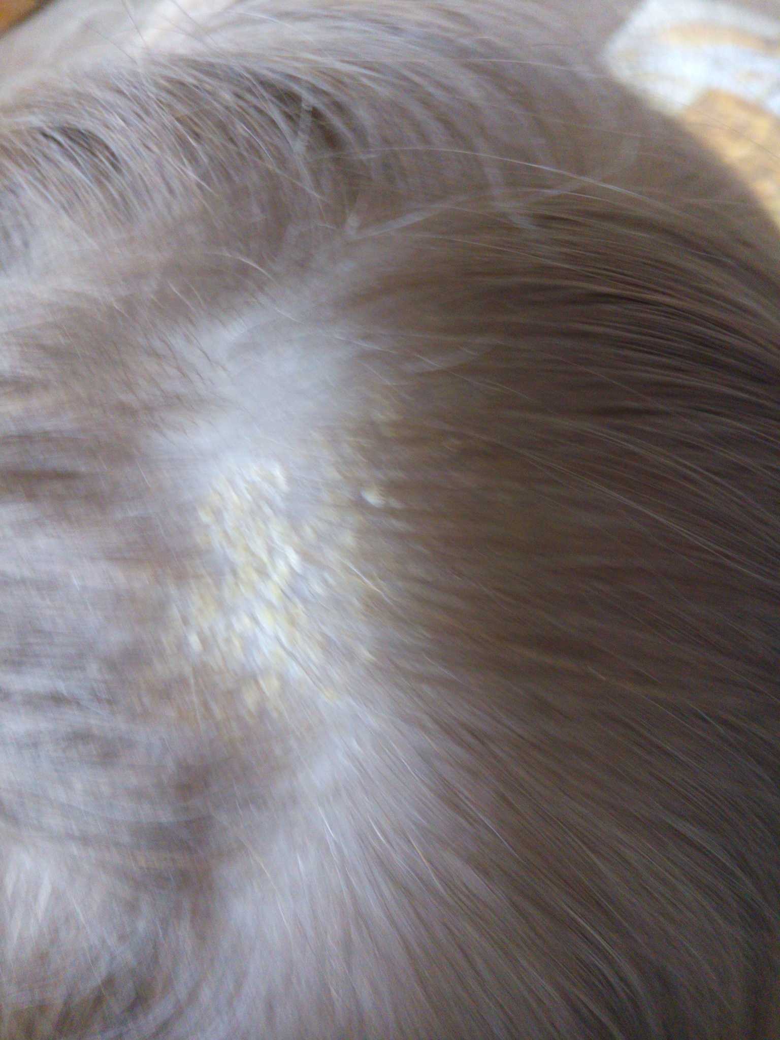 В чем причина появления красных пятен на голове под волосами, методы диагностики и лечения
