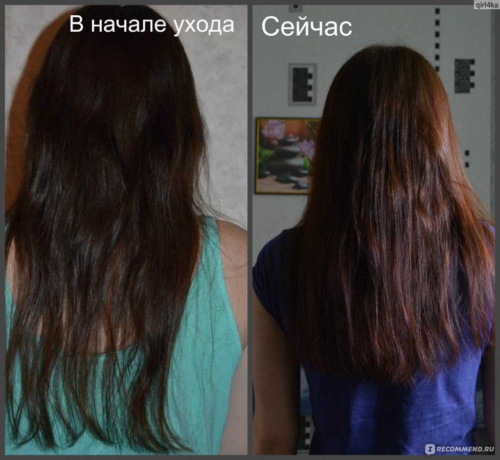 Восстановление волос после их выпадения