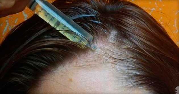 Польза и способы применения репейного масла для волос
