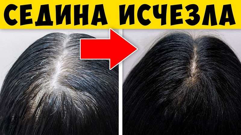 Какие пить витамины от седины волос