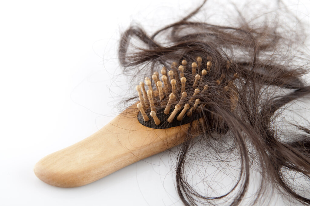 Выпадают волосы после родов: что делать, как остановить, почему сильно лезут локоны при грудном вскармливании, причины и лечение, витамины (элевит и другие средства), отзывы