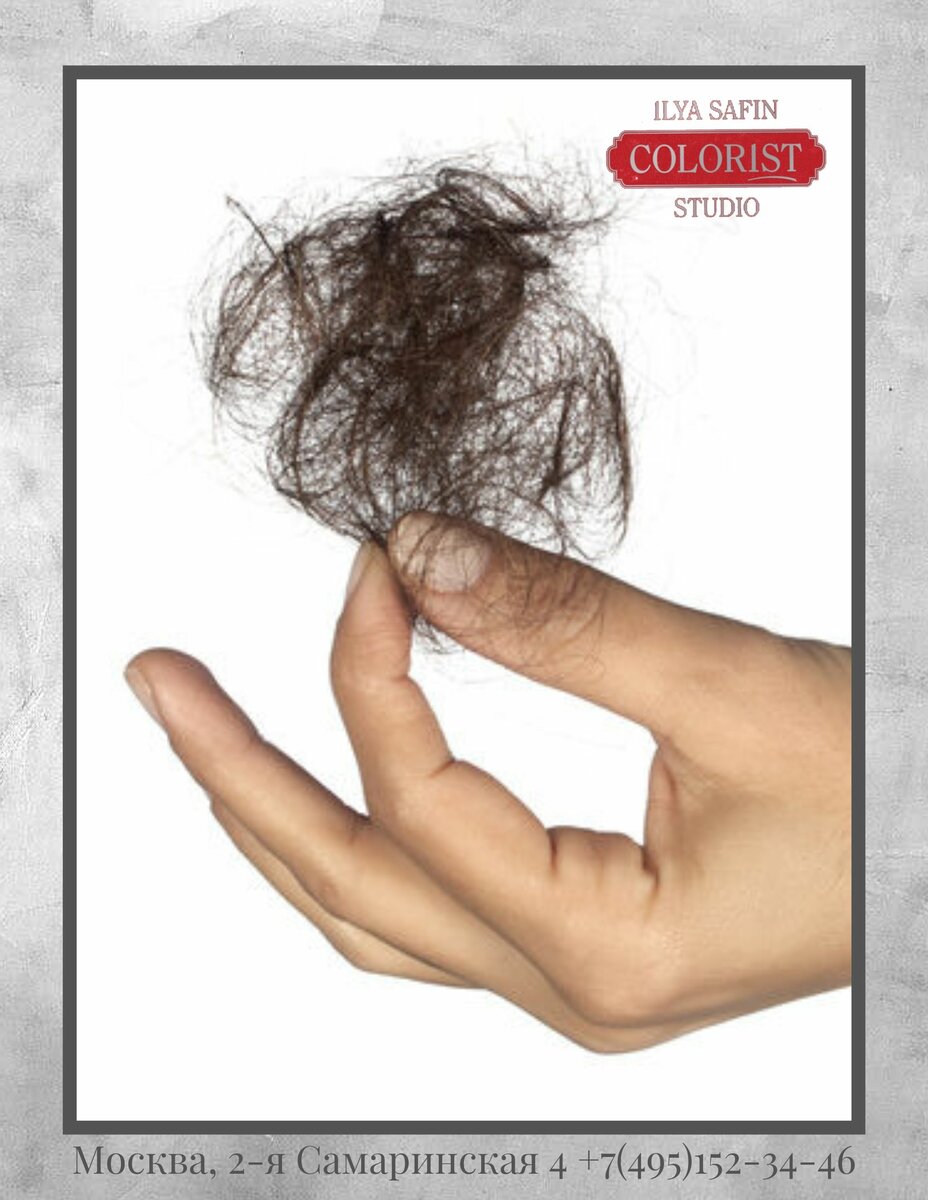 Выпадение волос у женщин: норма в день и причины отклонений