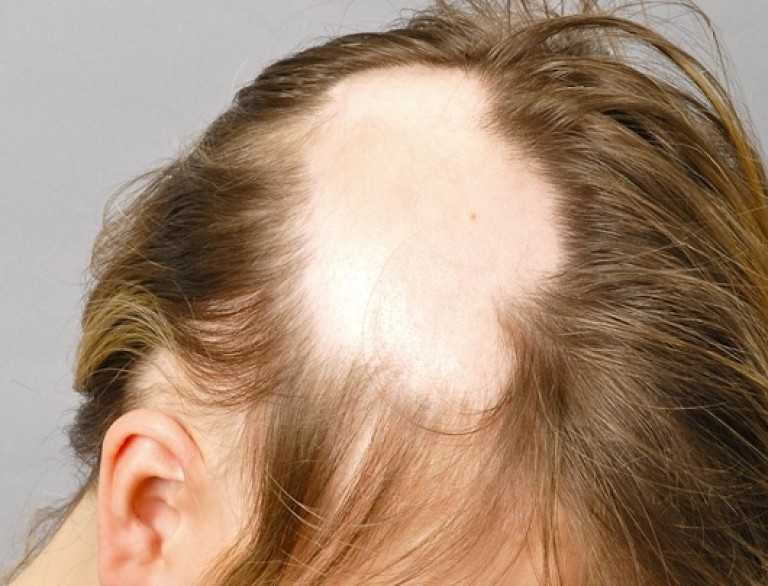 Что замедляет рост волос на голове. что делать если не растут волосы на голове: возможные причины и способы исправления. способы увеличения объёма