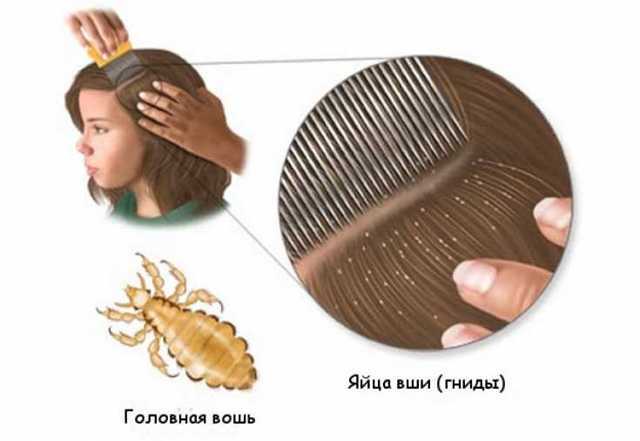 Механизм уничтожения вшей в процессе окрашивания волос