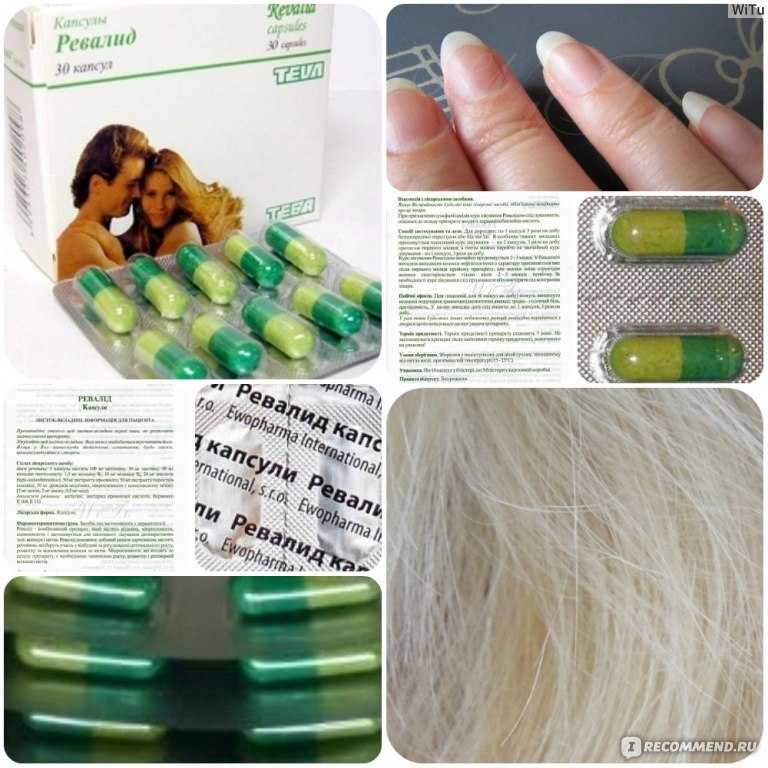 Что лучше для волос: ревалид или пантовигар. отзывы, показания к применению и стоимость обоих лекарственных препаратов.