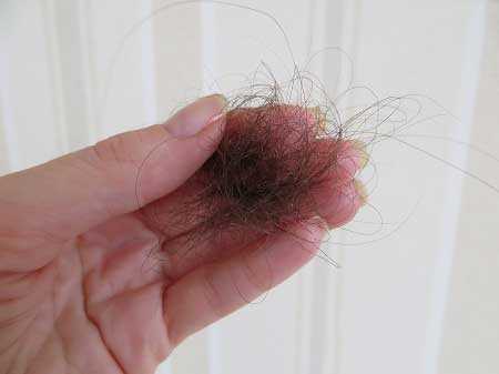 Выпадение волос у женщин: ежедневная норма и причины для беспокойства