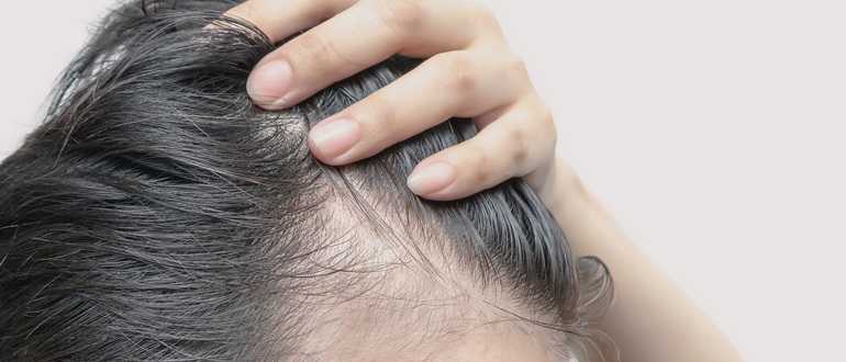 Почему болят волосы у корней на голове