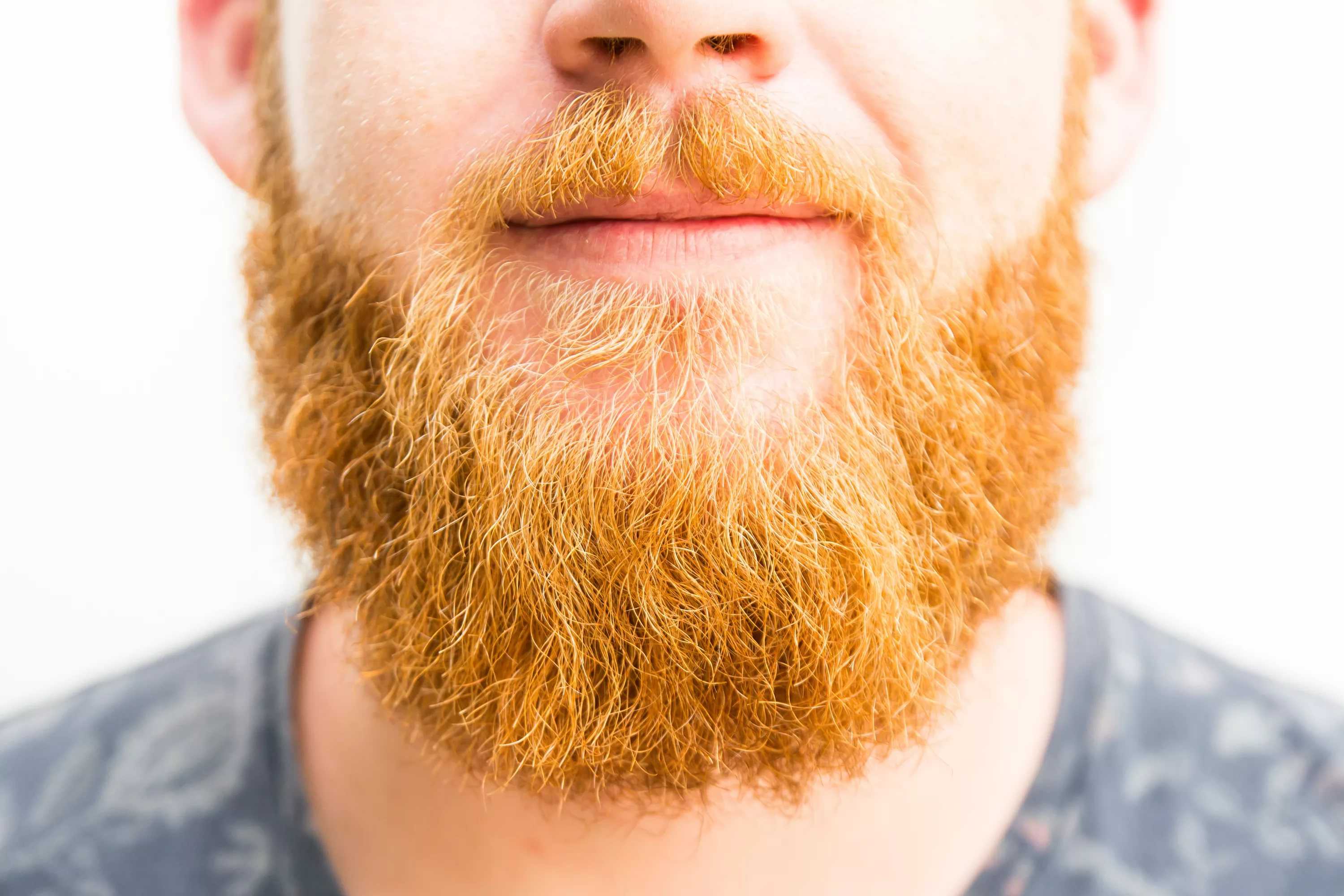Выпадают волосы на бороде: что делать и как лечить?
