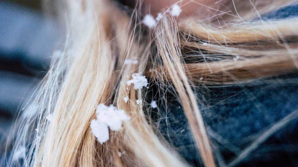 Главные правила ухода за волосами в холодное время: советы профессионала