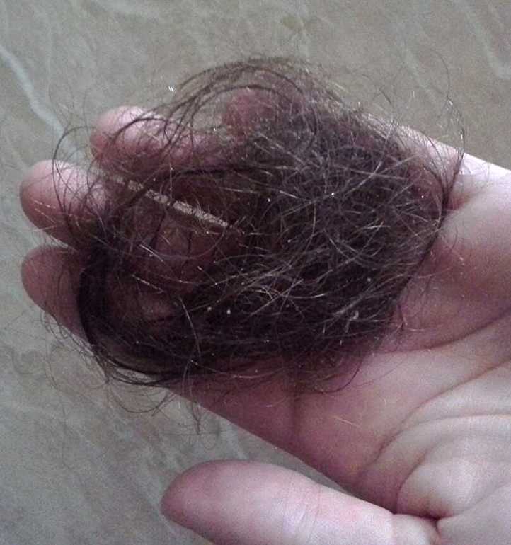 Сотное выпадение волос. Что значит если выпадают волосы