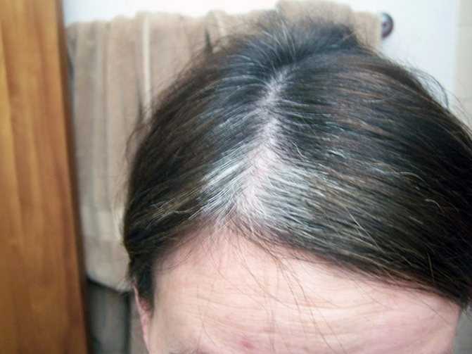 Витамины от седины волос: отзывы об использовании, как определить какого вещества не хватает, paba и другие витамины против поседения