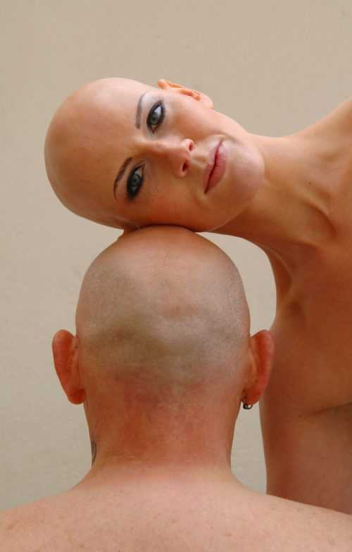 Алопеция после химиотерапии: как и почему выпадают волосы?