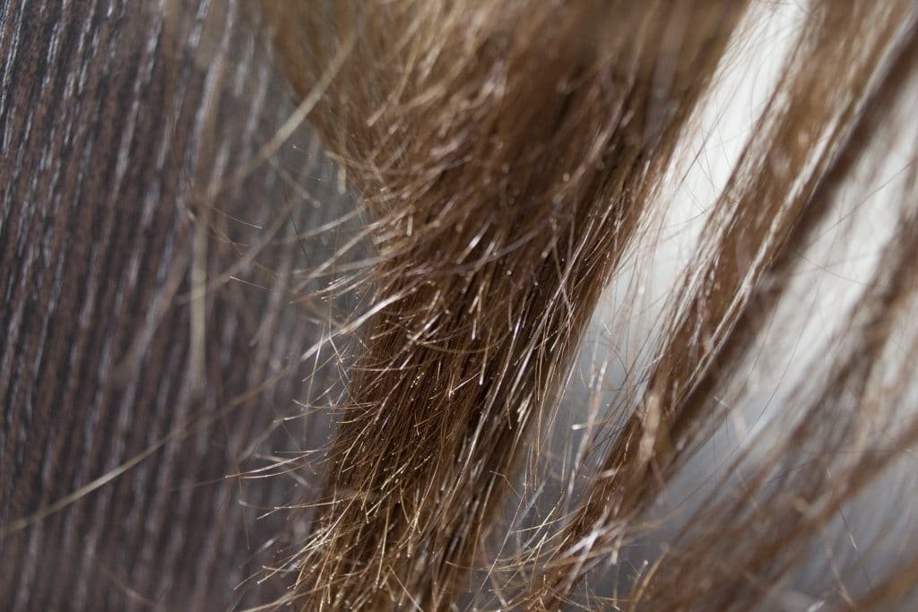 Секутся волосы по всей длине: что делать в домашних условиях