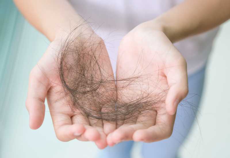 9 основных причин, почему выпадают волосы у девушек