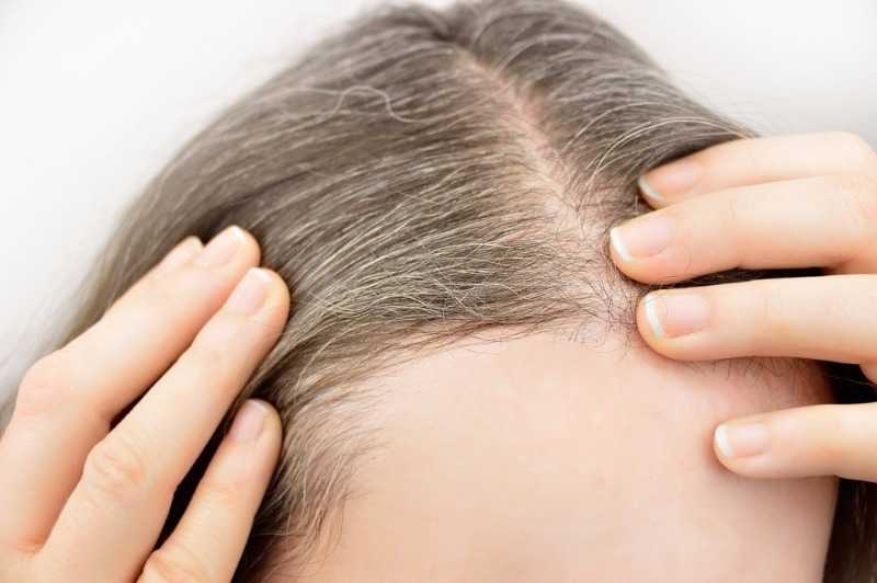 Почему седеют волосы у мужчин: причины, возраст. можно ли остановить поседение