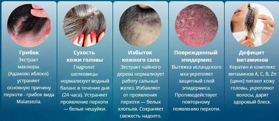 20 болезней кожи головы: симптомы заболевания волос и лечение волосяного покрова