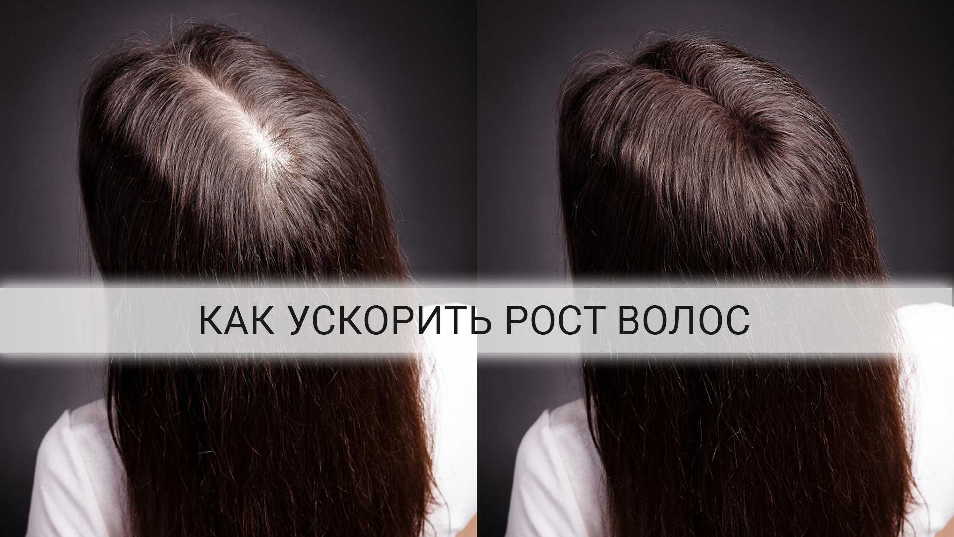 Как быстро отрастить длинные волосы — 10 способов, которые помогают