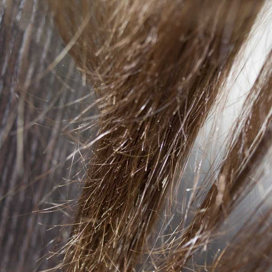 Секущиеся кончики волос: маски, лечение. почему секутся кончики волос