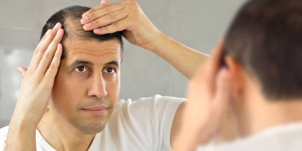 7 советов как остановить выпадение волос