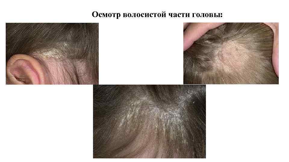 Криомассаж кожи лица и головы: когда эффективен, кому показан и как его выполнять