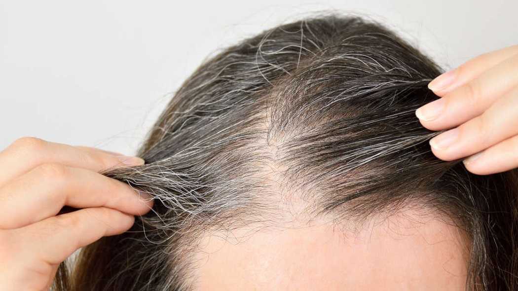 Как остановить седину волос: предотвратить седение у женщин и мужчин, как замедлить появление седых волос, есть ли лечение от поседения