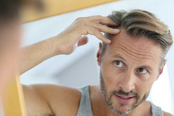 К какому специалисту надо идти при облысении – 3 вида выпадения волос