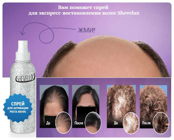 Как использовать спрей для роста волос генеролон. показания к применению и цена препарата. противопоказания.