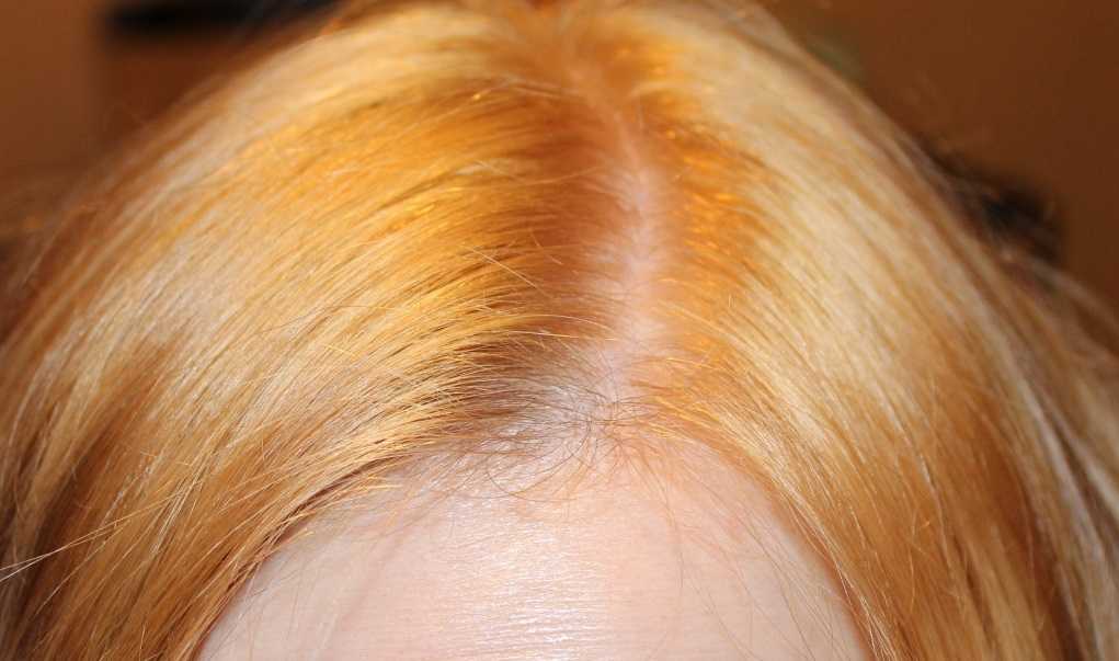Желтизна волос после окрашивания, осветления, обесцвечивания