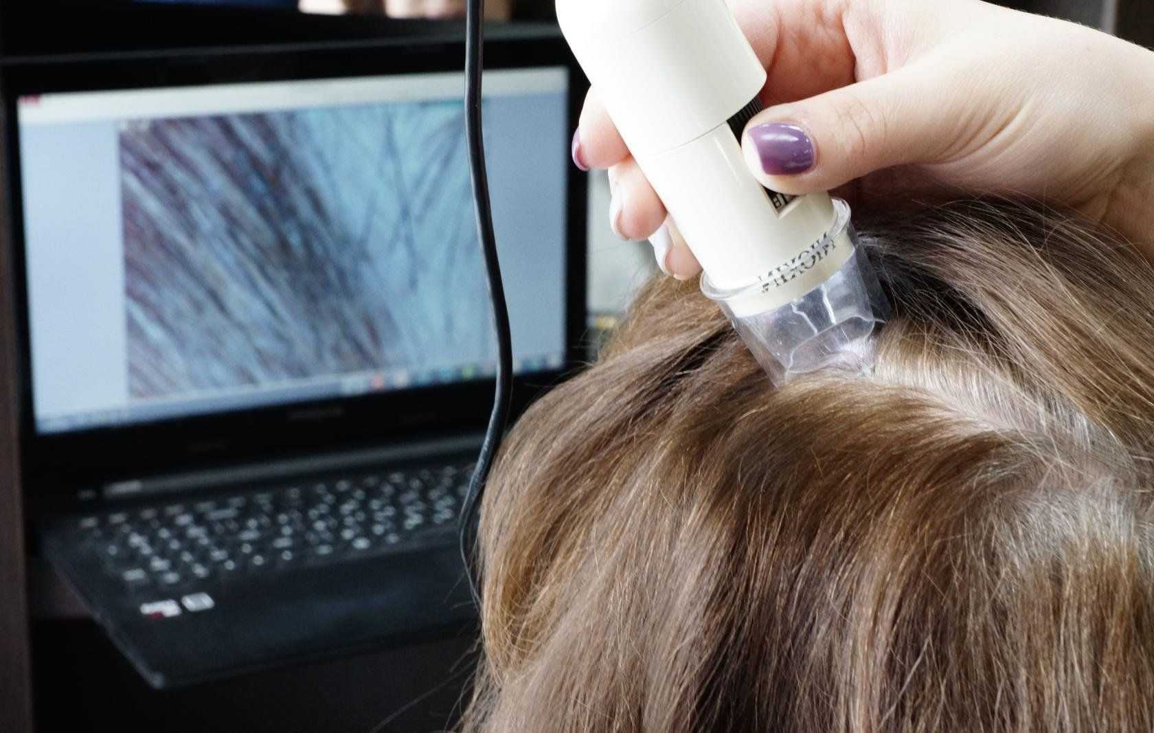 Принцип работы аппаратов для восстановления волос. разновидности методов: электрический, дарсонваль, магнитно-лазерная методика, лазерная терапия, расчески, ультразвук, инфракрасное облучение.
