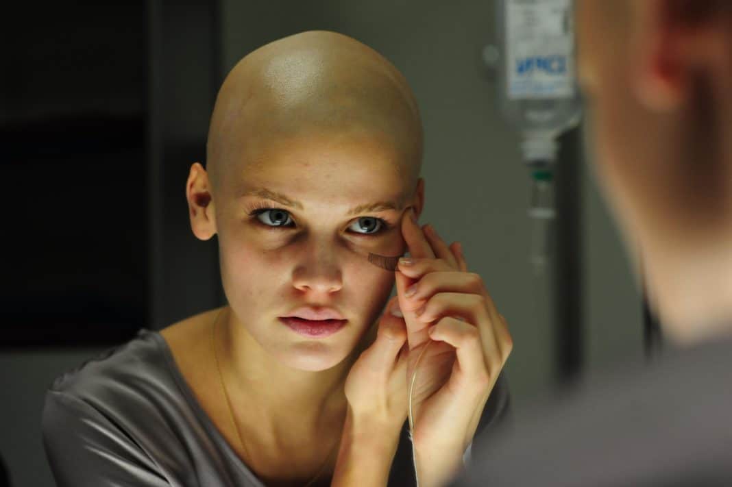 Восстановление волос после химиотерапии: самые эффективные методы