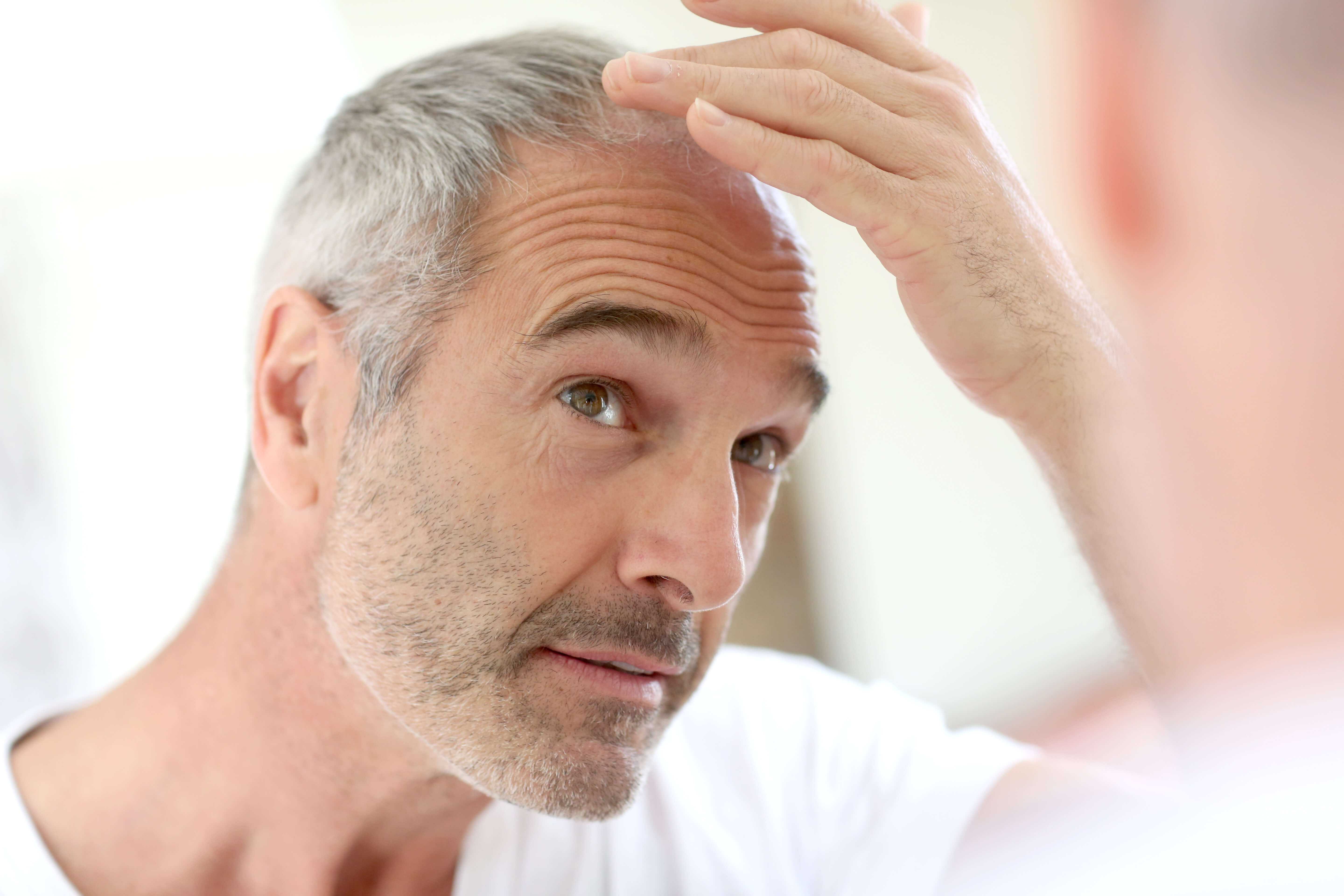 Почему волосы седеют слишком рано? ранняя седина волос: причины и лечение у женщин и у мужчин